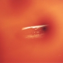 peephole